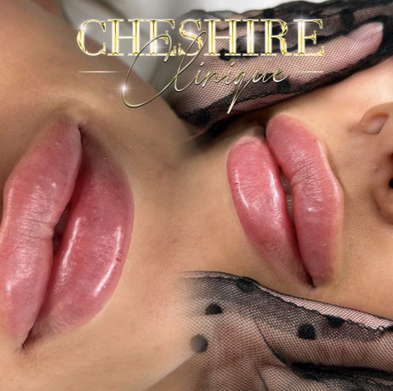 Cheshire Clinique