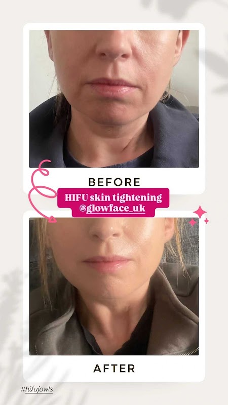 Glow Face Clinic