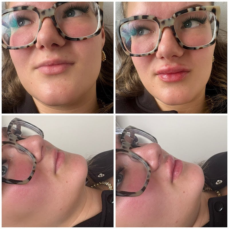 ICIE Aesthetics