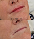 The Studio - Professional Aesthetics