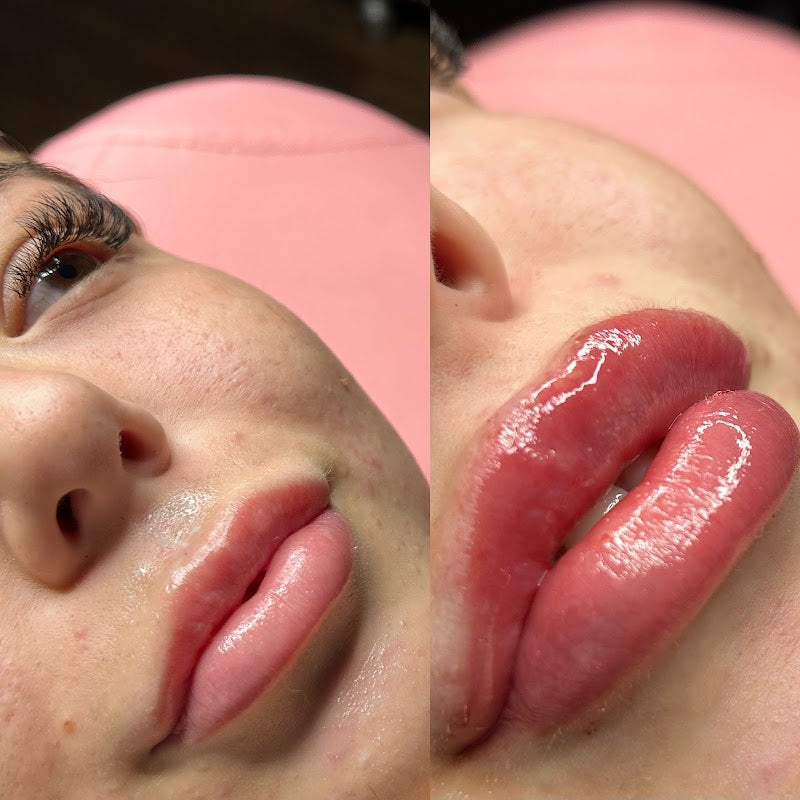 Bella Rose Aesthetics