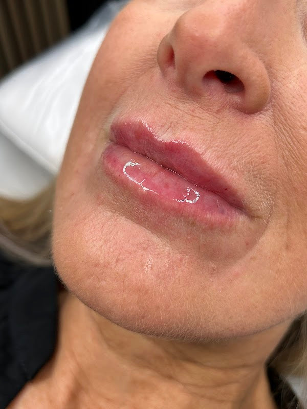 The Aesthetic Company | Botox | Lip Fillers | Skin